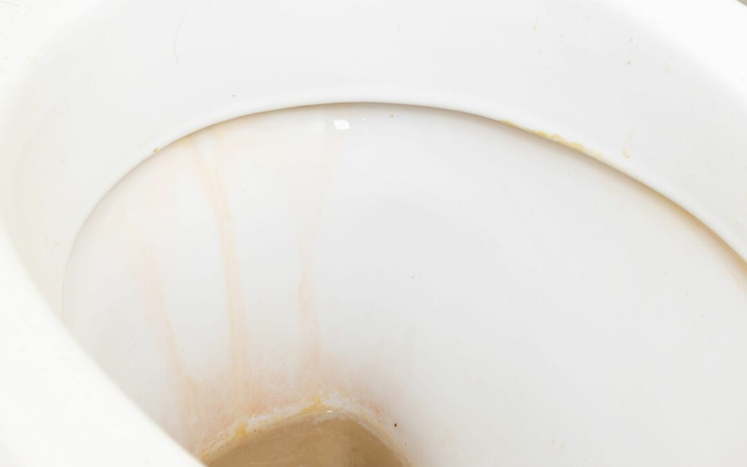 What Causes Brown Stains In A Toilet Bowl And How To Remove Them